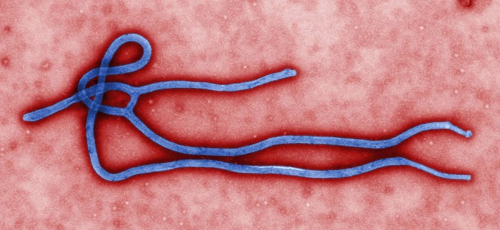 An electron micrograph of an Ebola virus virion